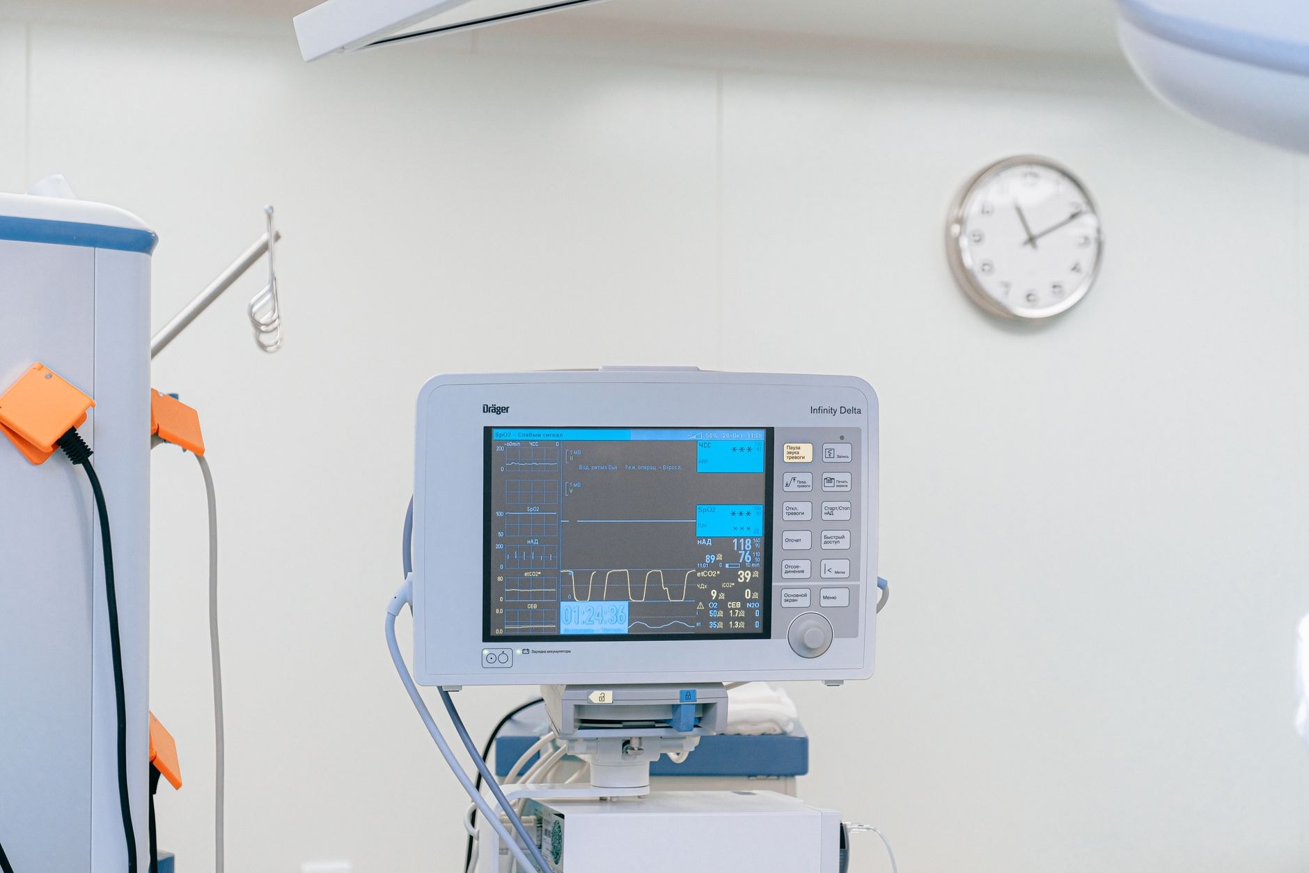 Aparat medical utilizat pentru monitorizarea funcțiilor vitale într-un spital
